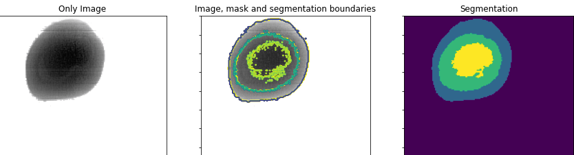 Image Processing and Analytics